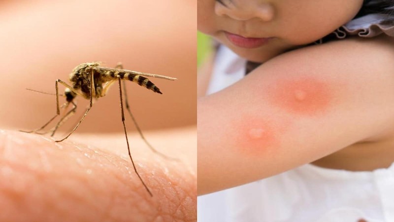 Συναγερμός με τα κουνούπια - Τι φέρνουν τα σμήνη που έρχονται